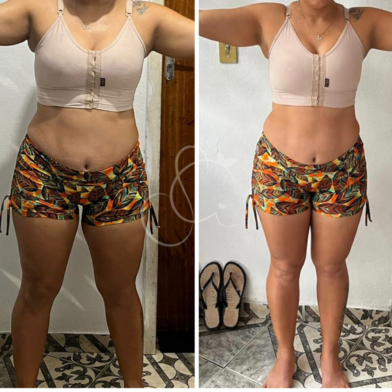 Simone-Andrade-Emagrecimento-Nutricionista-Ipatinga